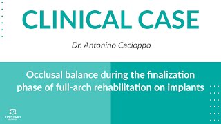 CLINICAL CASE Occlusal balance during the finalization phase of full arch rehabilitation on implants [upl. by Eizus]