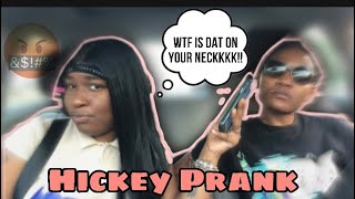 HICKEY PRANK GONE WRONG 🤬🤬 [upl. by Elias502]