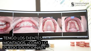 Tengo los dientes montados ¿cómo lo puedo solucionar [upl. by Hayden580]