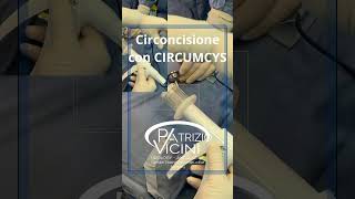 AndrologiaAndrologoCirconcisioneFimosi CircumcysCircumcisionProf Patrizio ViciniRoma [upl. by Aziza]