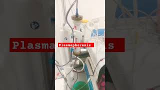 Plasmapheresis  T amp E Plasma transfusion During Dialysis  Kidney Disease  shortsfeedviralshort [upl. by Dloniger667]