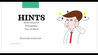 HINTS exam Head Impulse Nystagmus Test of Skew [upl. by Llenaej129]