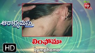 Aarogyamastu  Lymphoma  18th May 2017  ఆరోగ్యమస్తు [upl. by Benil731]