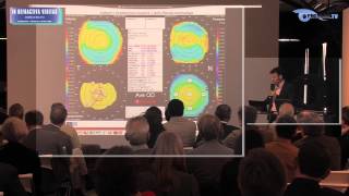 Prévention de lectasie post LASIK avec le logiciel SCORE Analyzer Dr Damien GATINEL Paris [upl. by Medrek]