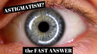 Astigmatism Explained in One Minute [upl. by Ashien112]