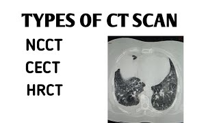 Types of Ct scan in hindi [upl. by Tatum587]