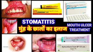 Stomatitis  मुंह के छाले का इलाज  Mouth Ulcer Treatment  Stomatitis In Hindi Muh K Chale Ka Ilaj [upl. by Bethezel]