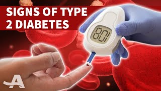 Early Signs of Type 2 Diabetes [upl. by Samanthia]