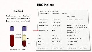 How to Interpret RBC Indices eg hemoglobin vs hematocrit MCV RDW [upl. by Reinertson]