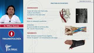 9 1 Fractura de escafoides 2024 [upl. by Ottie538]