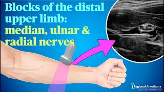 Ultrasound guided blocks of the median ulnar and radial nerves [upl. by Mcfadden885]