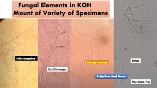 KOH mount of various samples with variety of Fungal elements [upl. by Allsopp]