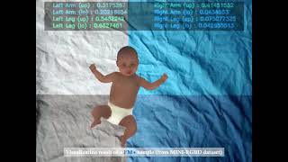 Identification of Abnormal Movements in Infants A DNN for Body Partbased Prediction of CP [upl. by Dnumsed]