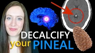 How To DECALCIFY Your PINEAL Gland amp What To EatTakeDo amp AVOID To Detox amp Cleanse The Pineal [upl. by Rosenkranz885]