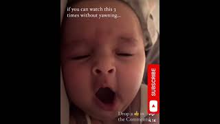 Baby yawning  drop comment you didnt yawn baby babyvideos cutebabies babiess [upl. by Kcinnay]