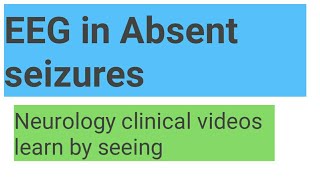 EEG in absent seizures [upl. by Demaria]