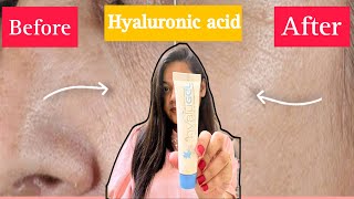 HYALU GEL HYALURONIC ACID gel Honest Review after Using 1 Month  Uses of Hyalu gel [upl. by Emya]