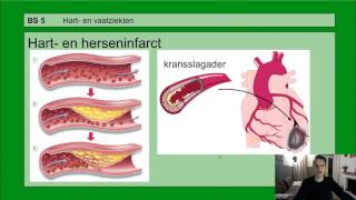 Basisstof 5 Hart en vaatziekten [upl. by Annoynek257]