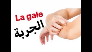 Épisode 43  Gale علاج الجرب مع الدكتور معاد [upl. by Notlim]