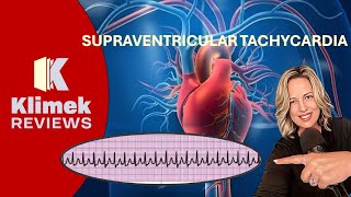 SVT  CARDIAC RHYTHM PRACTICE QUESTIONS WITH DR SHARON [upl. by Annoved]