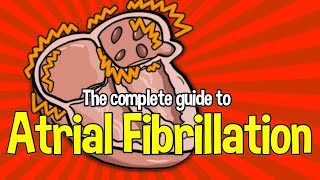 Complete Guide To Atrial Fibrillation Causes symptoms and treatments [upl. by Einnoc586]