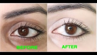 How to Remove Dark Circles Naturally in 3 Days 100 Results [upl. by Naihtsirc]