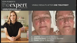 Manual Lymphatic Drainage Method with MYSKINBUDDY By The Expert Esthetician Erin Roberts [upl. by Eylk]