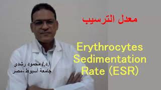 Erythrocytes Sedimentation rate ESR  معدل ترسيب خلايا الدم الحمراء [upl. by Penelope936]