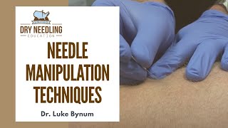 Dry Needling Needle Manipulation Techniques [upl. by Liahkim924]