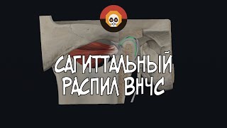 Сагиттальный распил ВНЧС 3D Анатомия [upl. by Shandie]