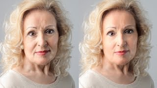 How to Get Rid of Forehead Wrinkles Fast  Remove Forehead Wrinkles [upl. by Ainslee]