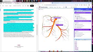 5152024  Mesenteric Arteriogram with Embolization [upl. by Gurl870]