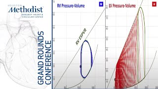 Cardiogenic Shock How Physiology has Changed Clinical Practice Daniel Burkhoff MD April 15 2021 [upl. by Alla]