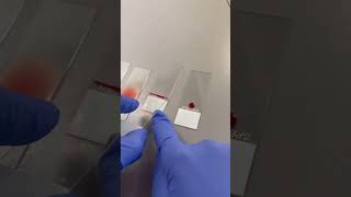 Smear makingmltlab medicalcenter bloodmltdmltpathologyhematology music [upl. by Coleman]