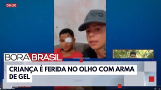 Criança passa por cirurgia após ser atingida no olho com arma de gel  Bora Brasil [upl. by Ahsilaf]