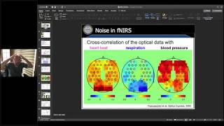 Motion Artifact and Corrections in NIRS Toolbox Brain AnalyzIR with Dr Ted Huppert [upl. by Nadaba]