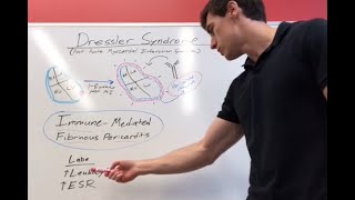 Dressler Syndrome Explained [upl. by Tteraj]