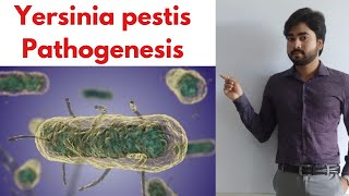 YERSINIA PESTIS  Pathogenesis  Types of Plague  Lab Diagnosis By Abhishek sir [upl. by Aurelio]