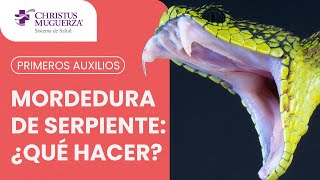 Mordedura de Serpiente ¿Qué debo hacer [upl. by Bui]