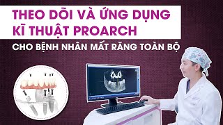 Trồng răng Implant toàn hàm tại TP HCM [upl. by Beker]