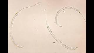 Dracunculus medinensis morphology life cycle pathogenesis diagnosis and treatment [upl. by Shanda]