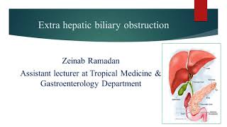 Extrahepatic biliary obstruction Algorithm  Dr Zeinab Ramadan [upl. by Nrubua]