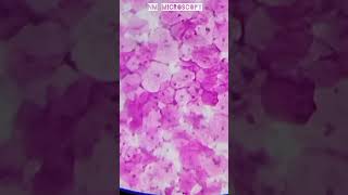 Squamous epithelial cells microscope slide🔬shortvideo youtube [upl. by Ednutabab418]