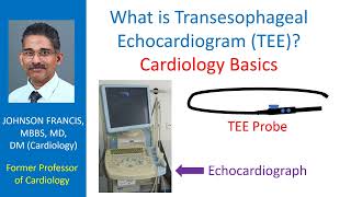 What is Transesophageal echocardiogram TEE Cardiology Basics [upl. by Grefer]