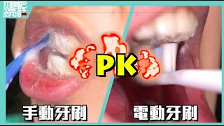 電動vs手動牙刷，哪種刷比較乾淨？ [upl. by Brie]