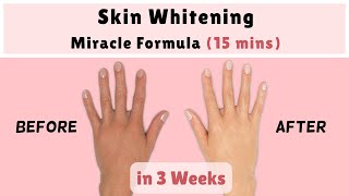 Skin Whitening Remedy Full Body  Tamil [upl. by Kitty]