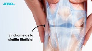 Síndrome de la CINTILLA ILIOTIBIAL  Ejercicios y Tratamiento [upl. by Aisek]