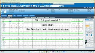 Voice Enabled Perio Charting amp PHI Reporting for Denticon with Denti AI Voice [upl. by Rednas675]