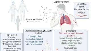 Mycobacterium Leprae  Causative Organism of Leprosy [upl. by Gilburt]