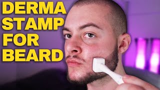 How To Derma Stamp Beard Properly Derma Stamp Tutorial Minoxidil amp Derma Stamp [upl. by Ahsirak]